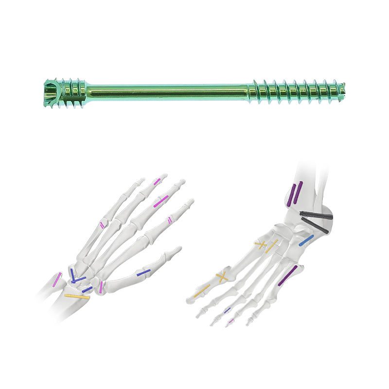 Herbert Cannulated Compression Screw