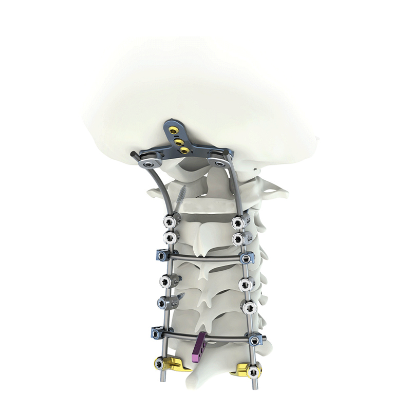 Do you know cervical spine fixation screw system?