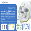 Maxillofacial Plate 1.5mm oo is-qodida
