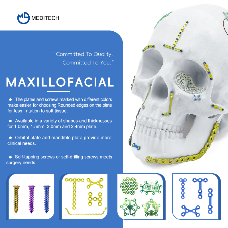 Maxillofacial Plate 1.5mm oo is-qodida