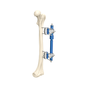 Micro-motion Type External Fixator 7100-21