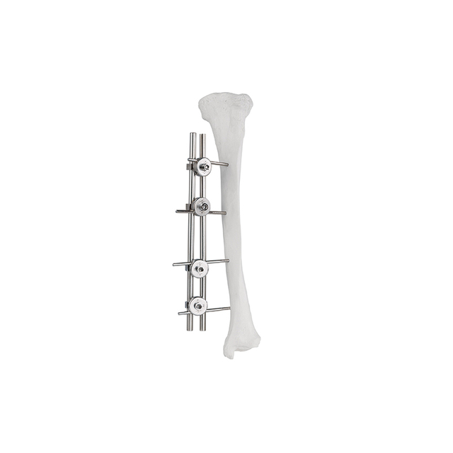 Double Rod Single Side External Fixator