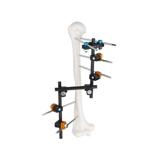 Z Frame(T Type) External Fixator