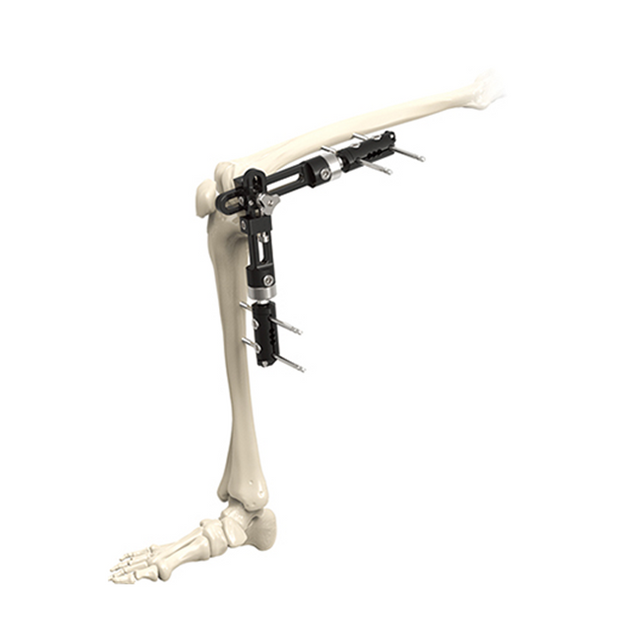 Fissatore esterno dell'articolazione del ginocchio
