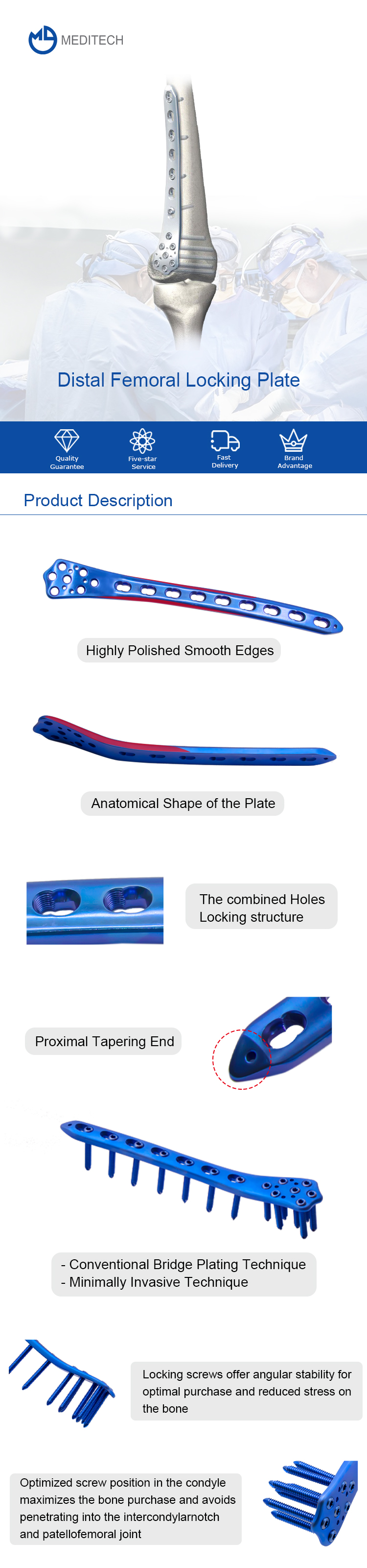 Distal Femoral Locking Plate