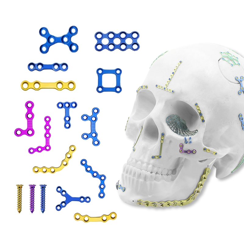 1.5mm Maxillofacial Plate System