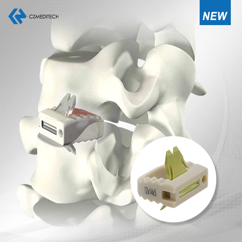 Uni-C Standalone Cervical Cage