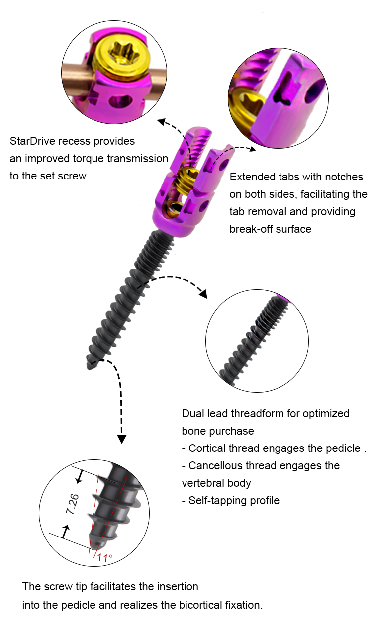 5.5 Details of spinal nails
