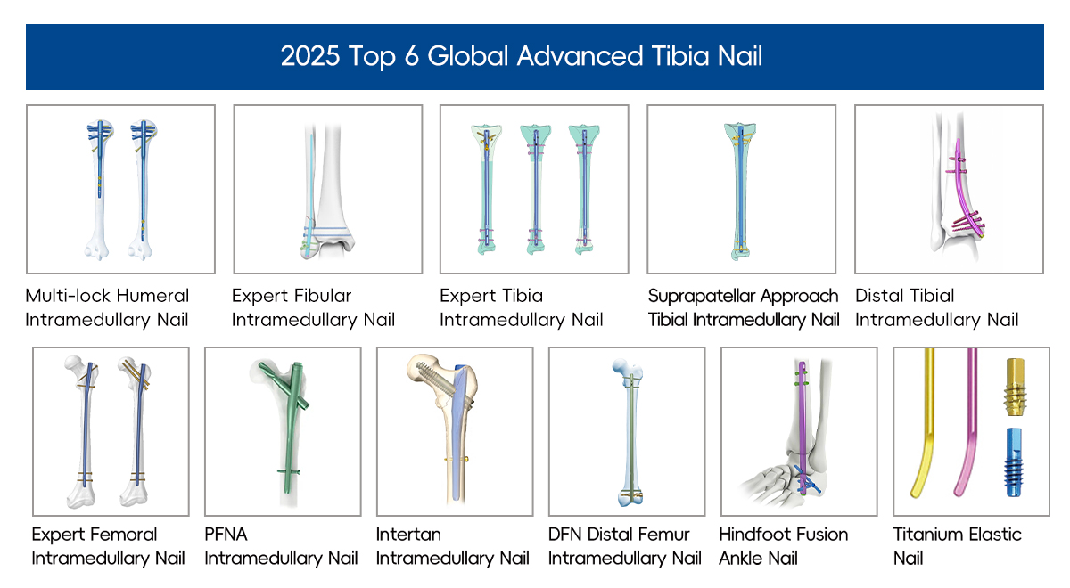Global Advanced Tibia Nailing Instruments Name 2025 Top 6 Innovations