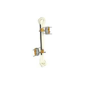 Humeral Shaft External Fixator