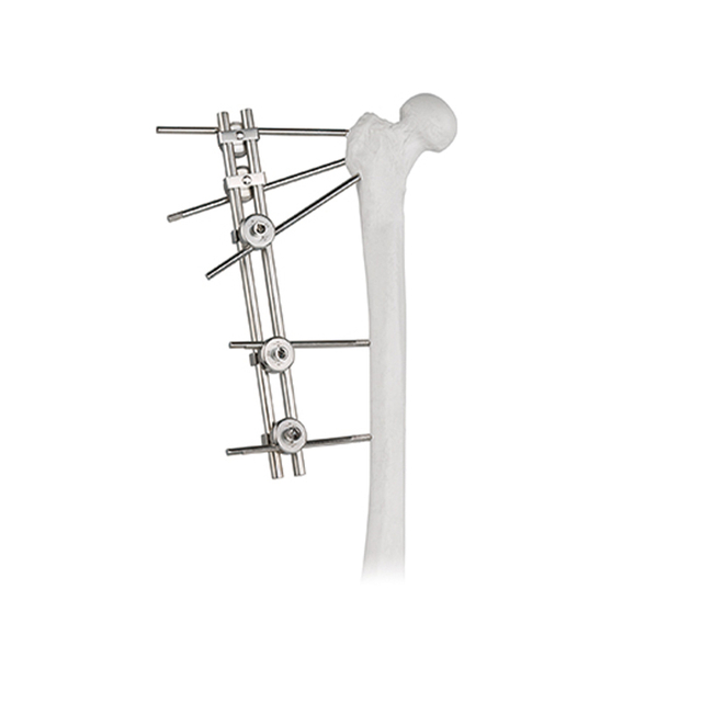 Double Rods Tuberosity External Fixator