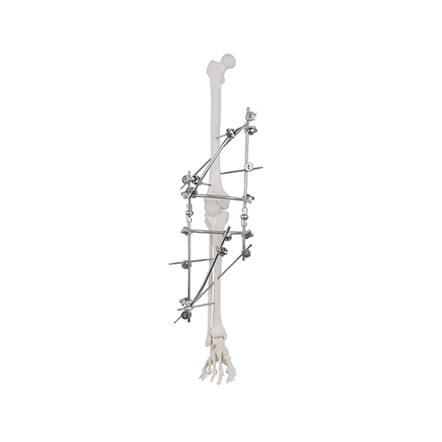 Knee Joint External Fixator 9100-2701