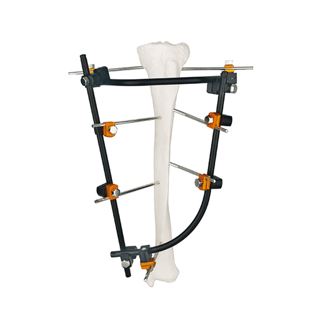 Tibial Joint Side External Fixator