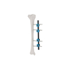 Straight Type External Fixator 8100-14