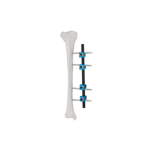 Straight Type External Fixator 8100-14