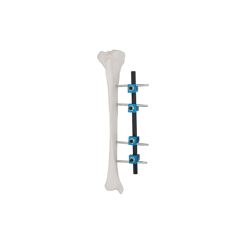 Straight Type External Fixator 8100-14