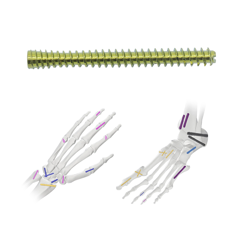 Herbert Cannulated Compression Screw