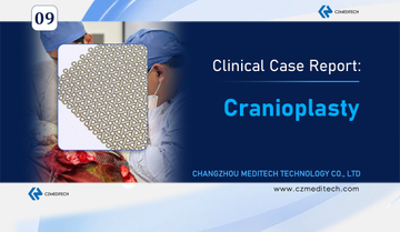 Titanium mesh cranioplasty surgery in Morelia Mexico using MEDITECH implants-czmeditech.jpg