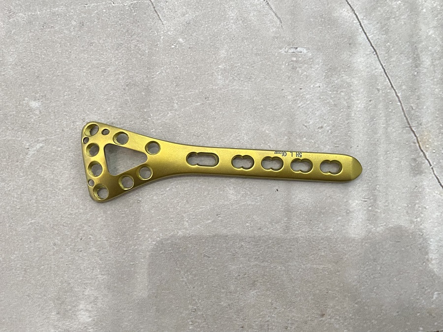 Distal Dorsal Radial Delta Locking Plate