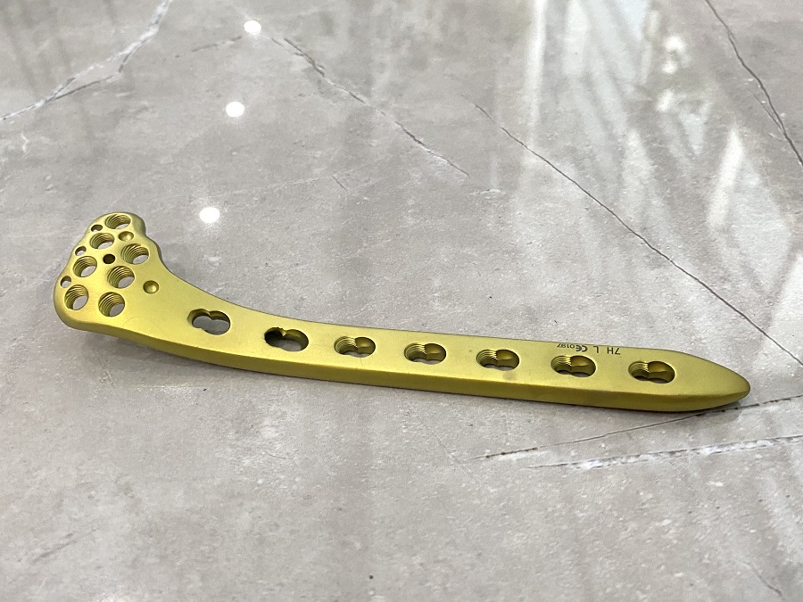 Proximal Lateral Tibial Locking Plate