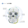 Maxillofacial Plate 1.5mm oo is-qodida