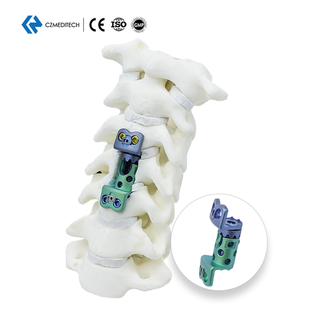 Cervical Expandable Titanium Mesh Cage