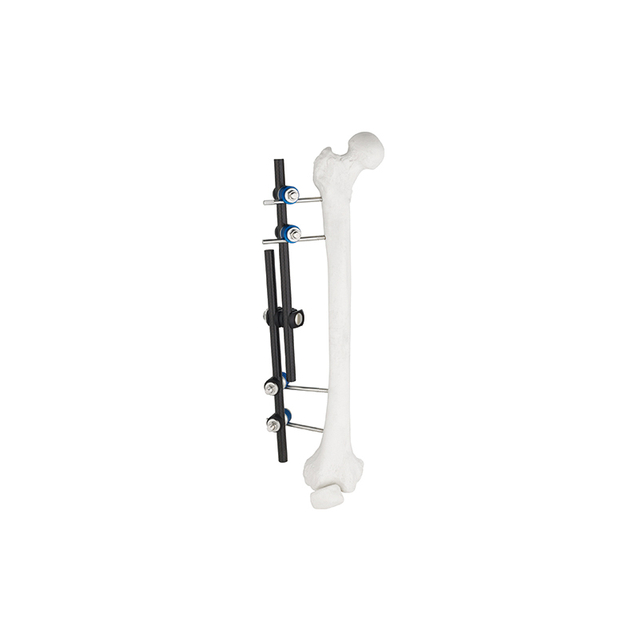 Straight Type External Fixator 8100-10