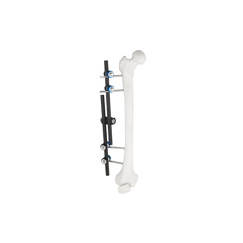 Straight Type External Fixator 8100-10