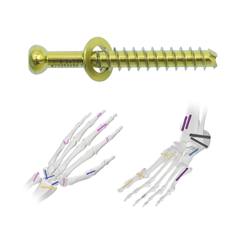Herbert Cannulated Compression Screw