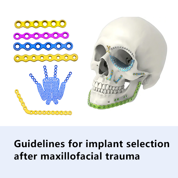 Tilmaamaha xulashada gacantu ka dib dhaawacyadii Maxillofacial