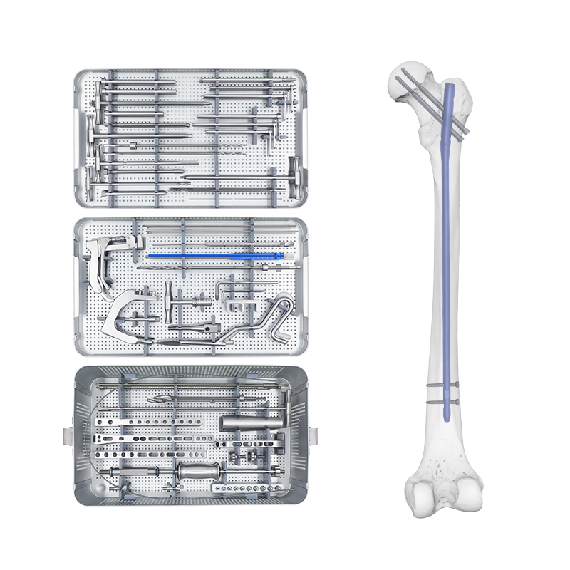 U C femorariu intramedlatu Intratuppullaria Expert Set