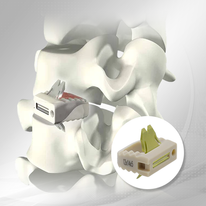 Uni-c stand-alone cervicale kooi