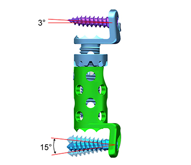 spinal surgery cage-4