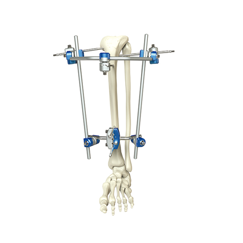 Proximal Tibia External Fixator