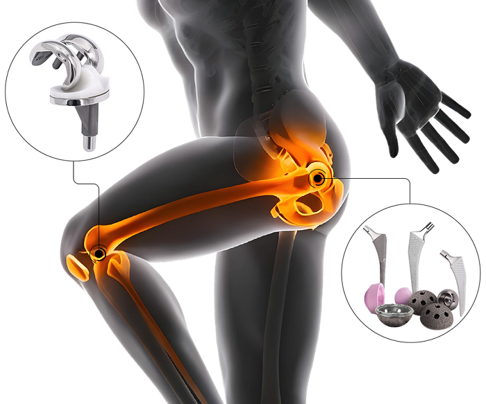 Hip & Knee