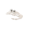Mini-External Fixator(Finger & Palm)