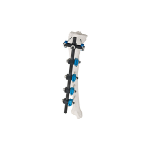 T Type External Fixator 8100-12