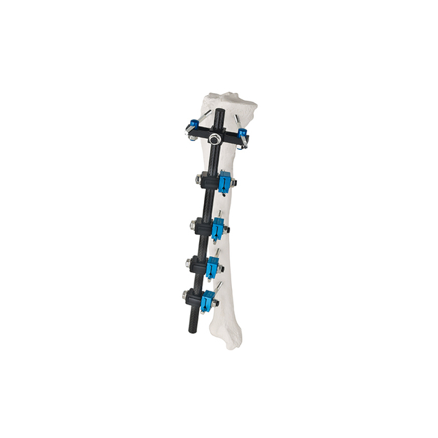 T Type External Fixator 8100-12