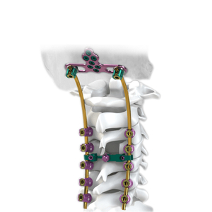 Posterior Cervical Screw System