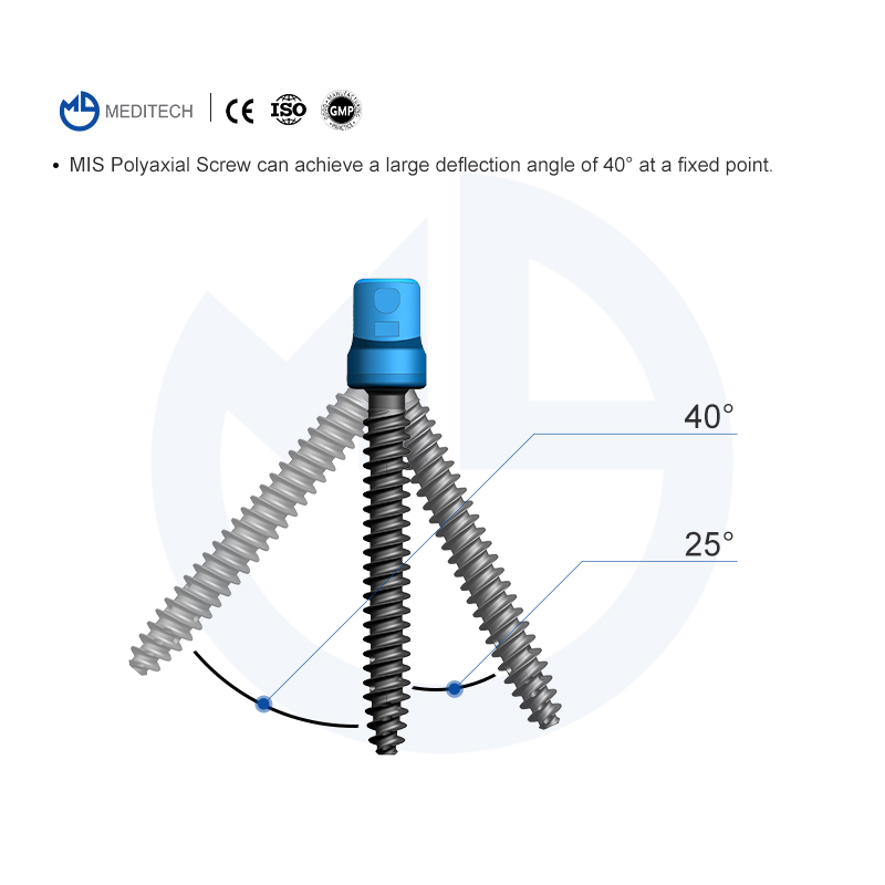 MIS Spinal Pedicle Screw System(5.5mm System)