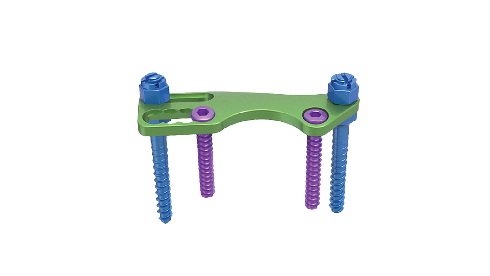 VENTA-T™ Anterior Thoracic Plate System