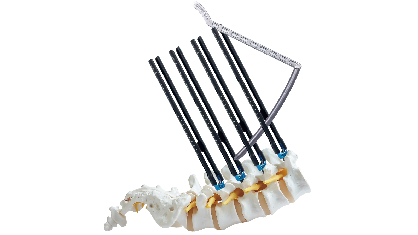 CORZA™ 5.5 MIS Thoracolumbar Fixation System