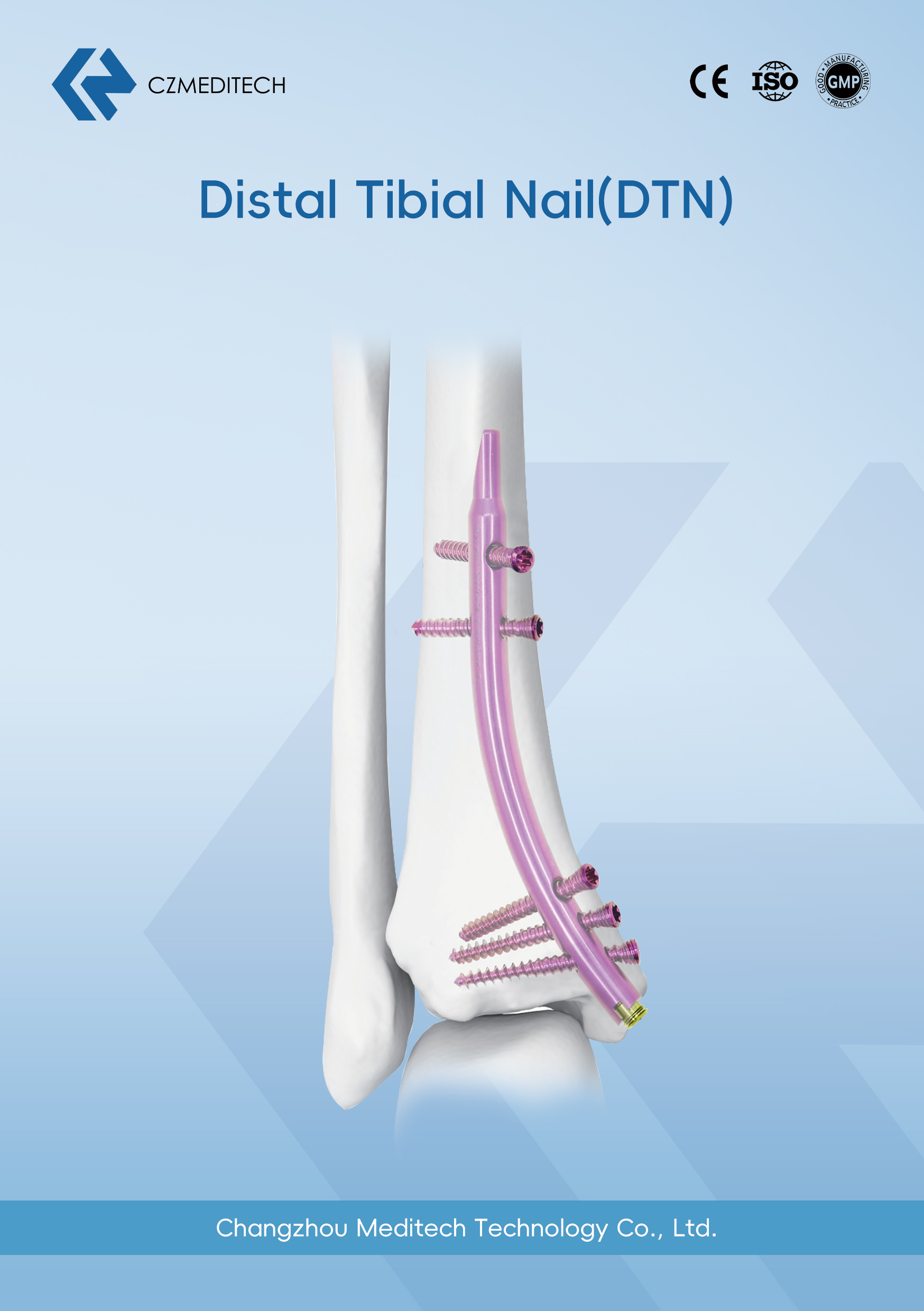 Intramedullary Nail Systems-CZMEDITECH