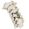 V&AElig;DDER Anterior cervikal plade-III