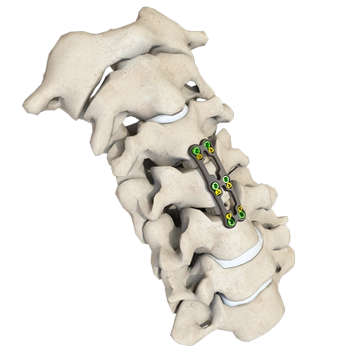 V&AElig;DDER Anterior cervikal plade-III