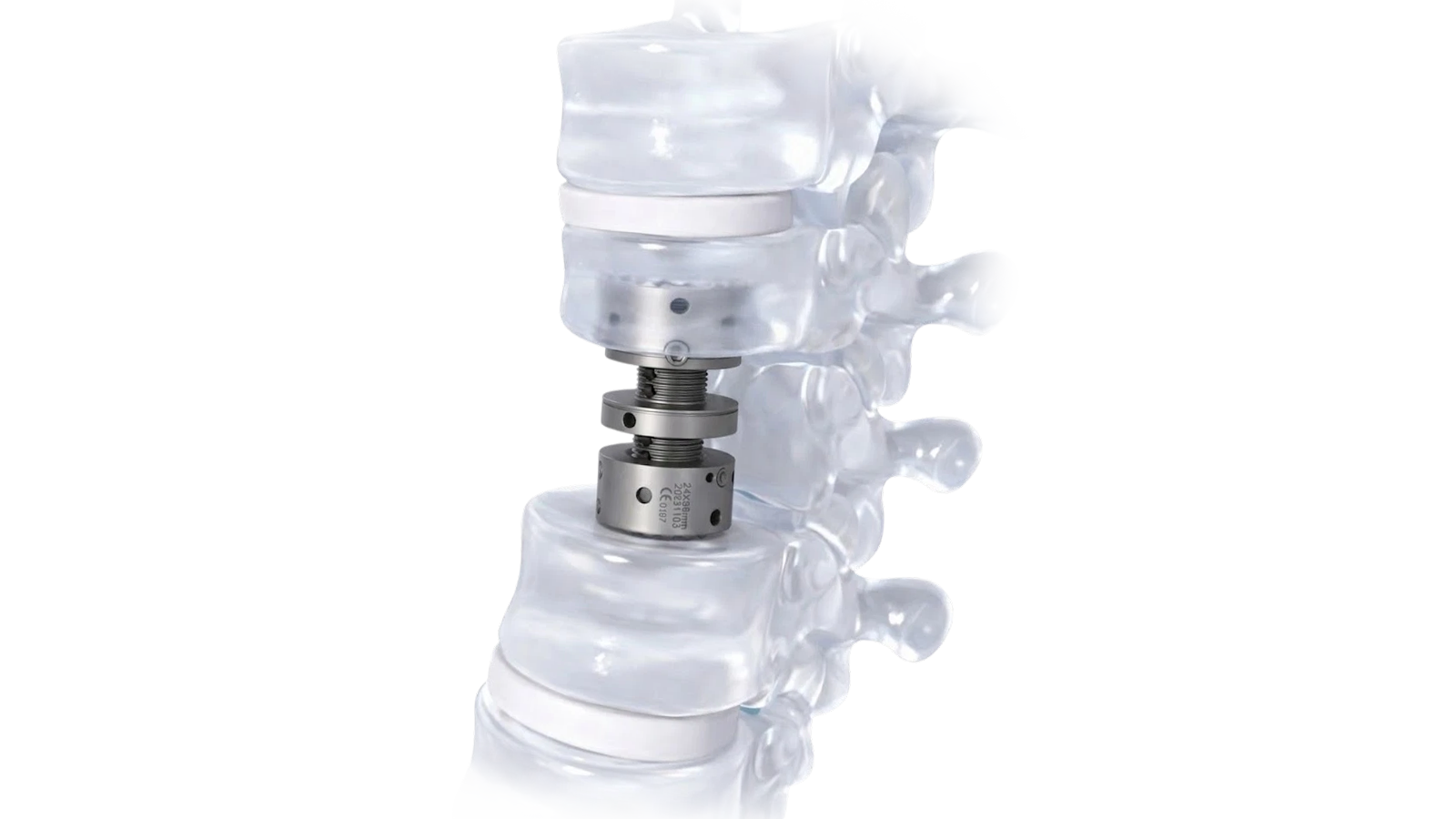 VERTA-X™ Expandable VBR System
