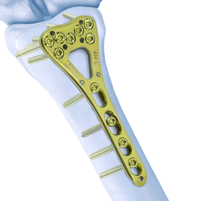 CZMEDITECH locking plate system