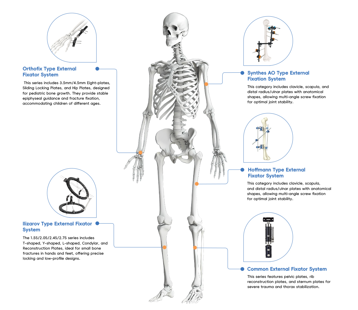 Classification of Orthopedic External Fixation