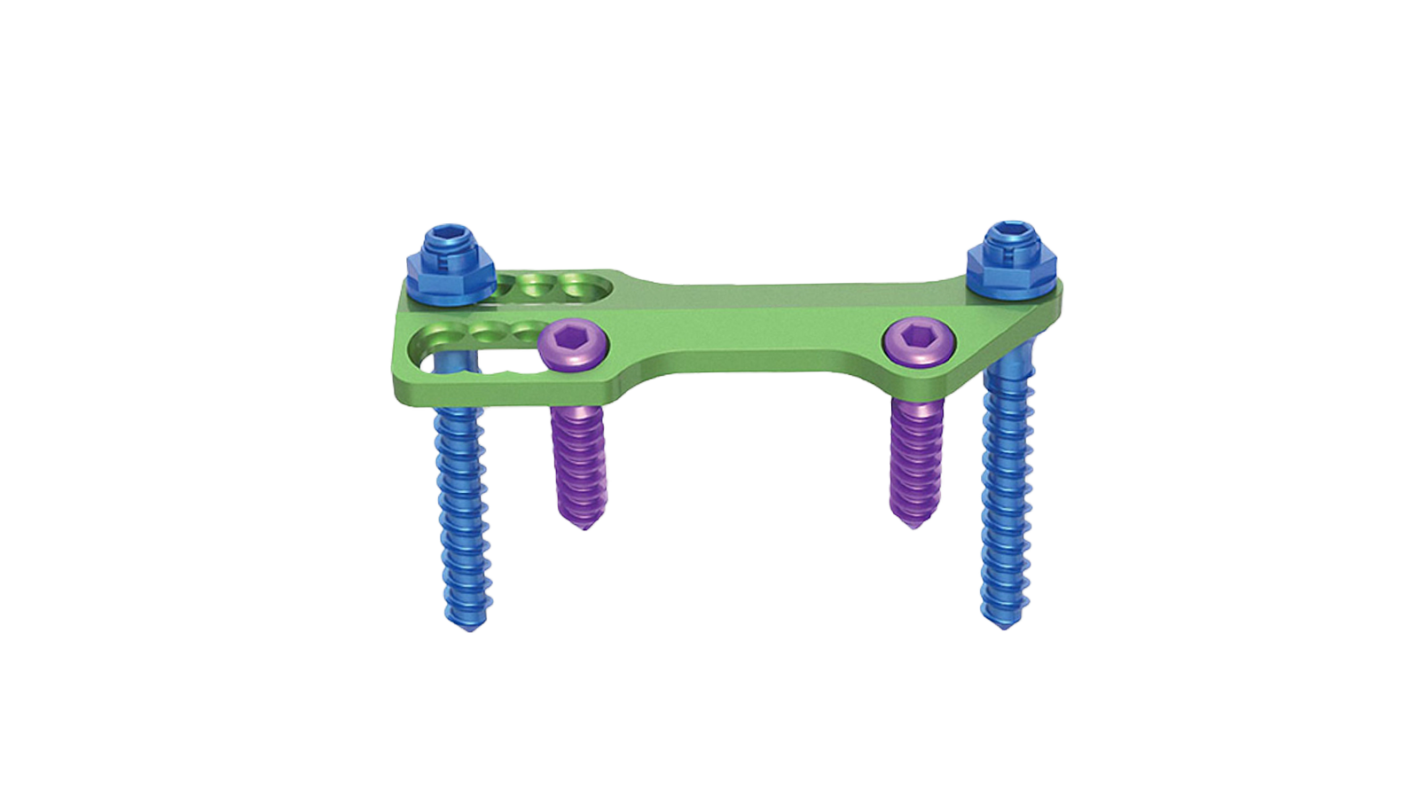 VENTA-TL™ Anterior Thoracolumbar Plate System