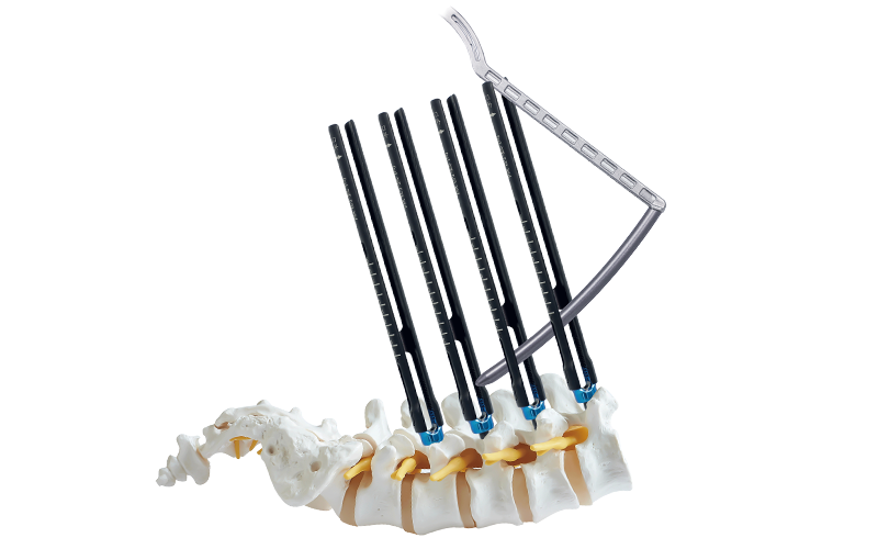 MIS-Spinal-Pedicle-Screw System-(5.5mm-System)